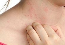 Quyết định số 75/QĐ-BYT ngày 13/01/2015 về việc ban hành tài liệu chuyên môn “Hướng dẫn chẩn đoán và điều trị bệnh da liễu”.