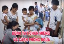 Bệnh Tay chân miệng và cách phòng ngừa.