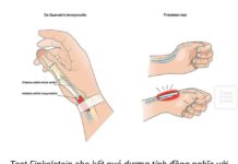 Hội chứng De quervain