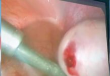 Phẫu thuật nội soi trường hợp đặc biệt.